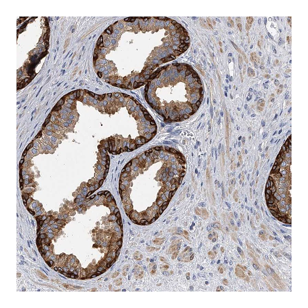 Atlas Antibodies Anti-PYGB Antibody