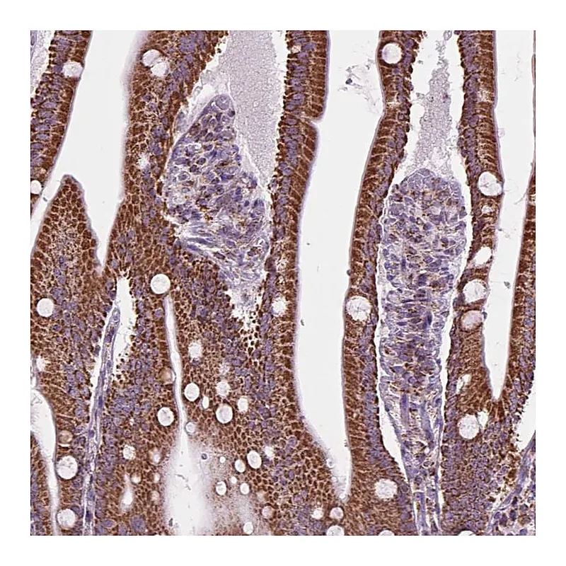 Atlas Antibodies Anti-PYCRL Antibody