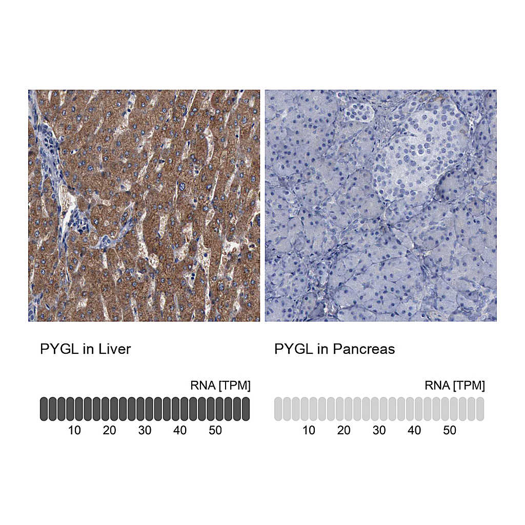 Atlas Antibodies Anti-PYGL Antibody