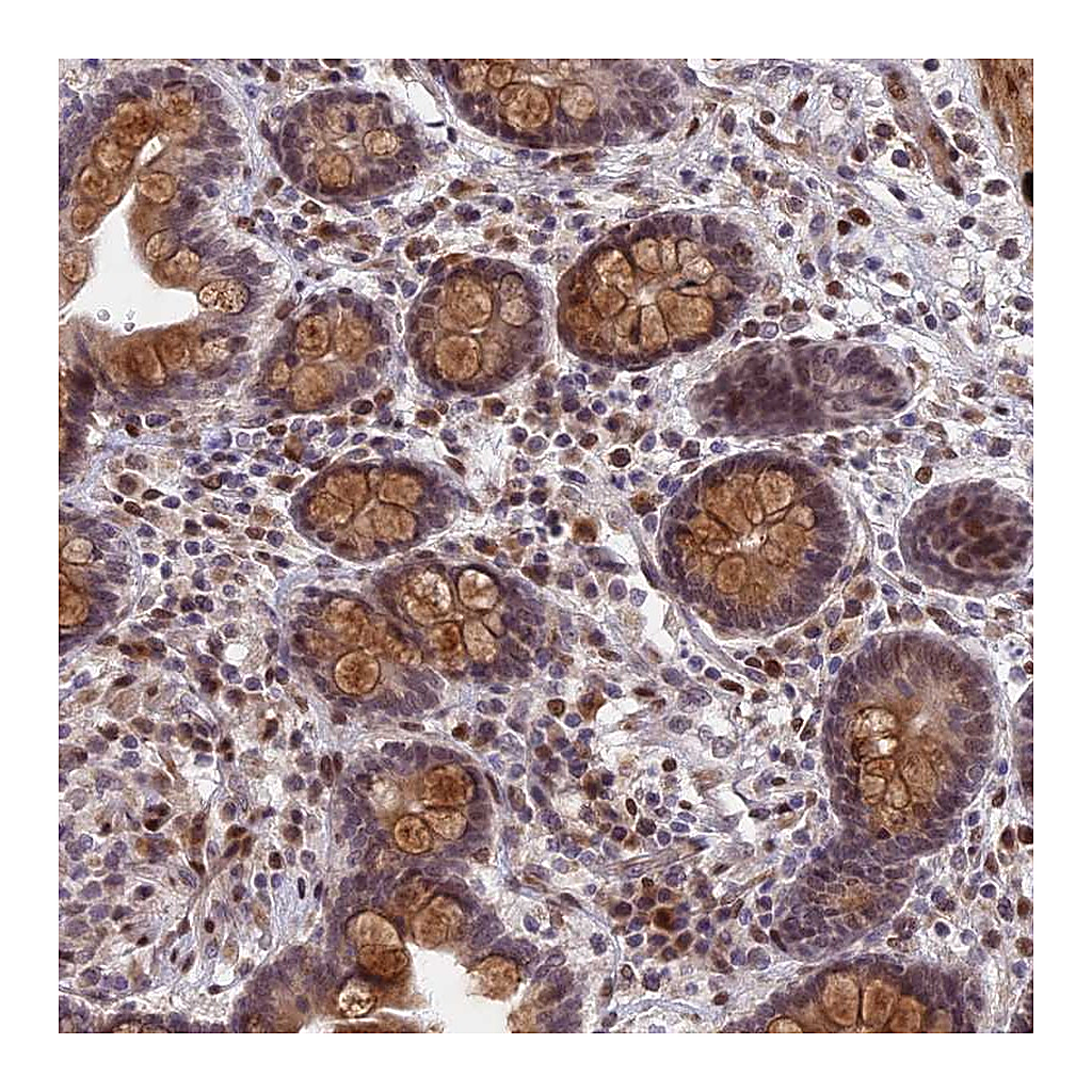 Atlas Antibodies Anti-PYGO1 Antibody