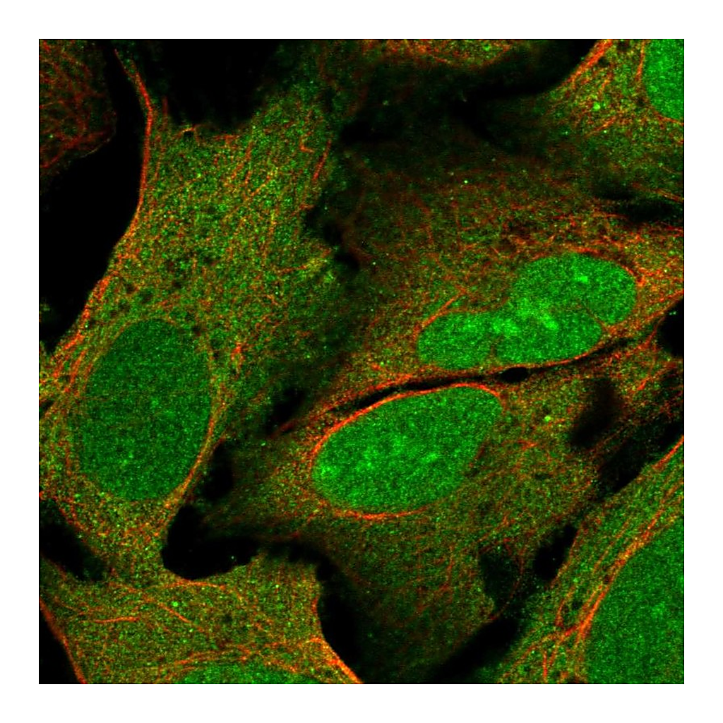 Atlas Antibodies Anti-PYM1 Antibody