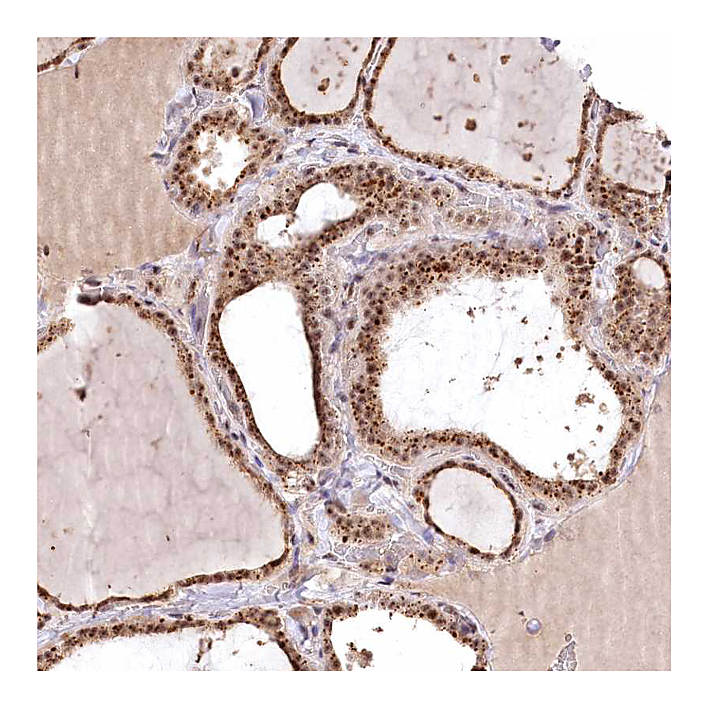 Atlas Antibodies Anti-PYROXD1 Antibody