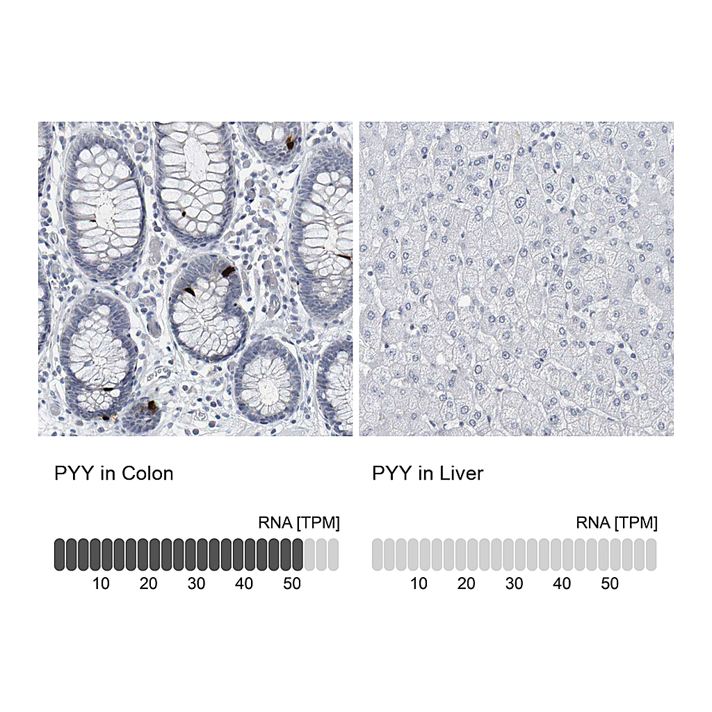 Atlas Antibodies Anti-PYY Antibody