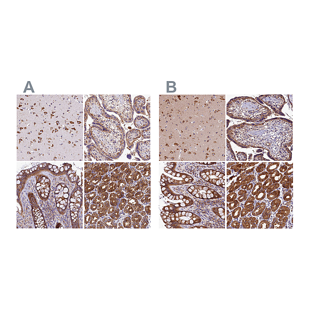 Atlas Antibodies Anti-QARS Antibody