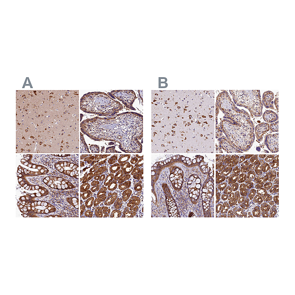 Atlas Antibodies Anti-QARS Antibody