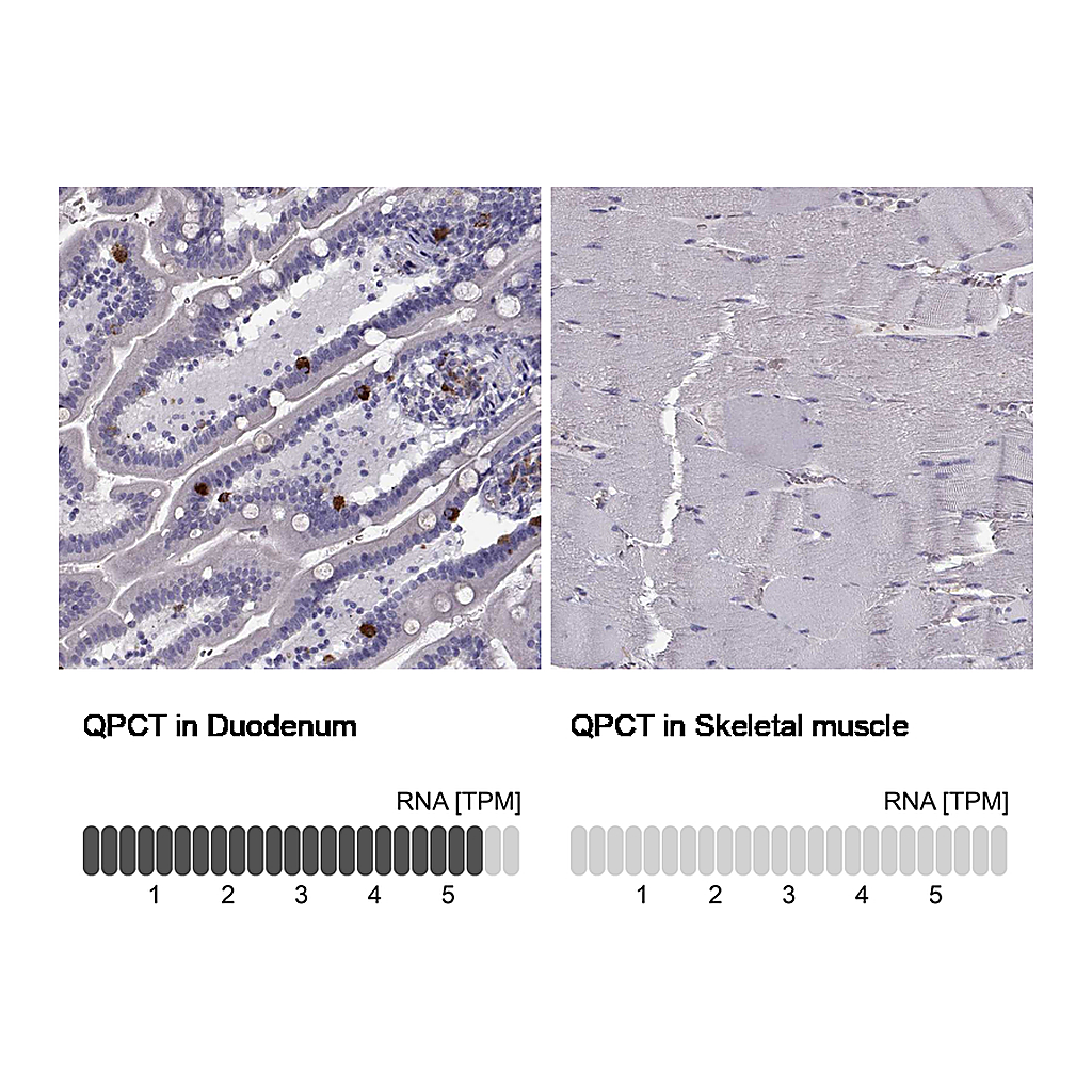 Atlas Antibodies Anti-QPCT Antibody