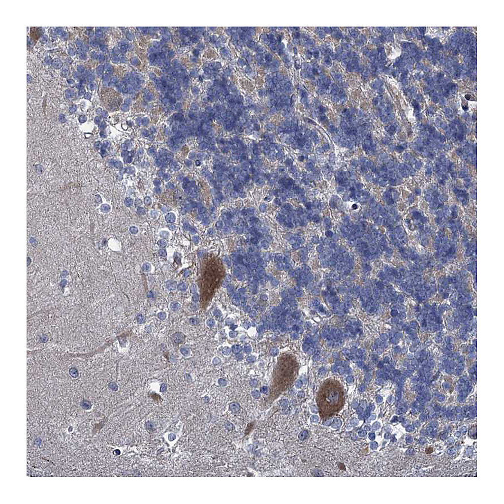 Atlas Antibodies Anti-QPCTL Antibody