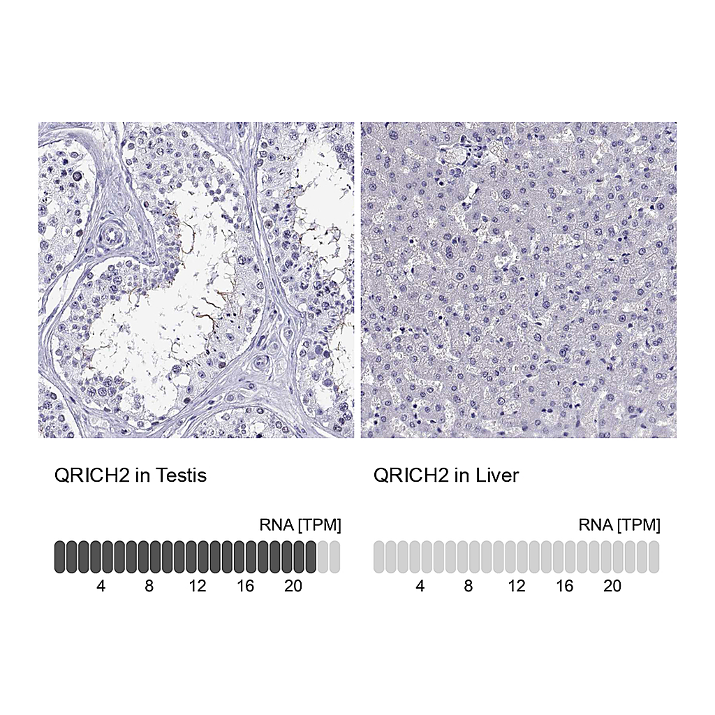 Atlas Antibodies Anti-QRICH2 Antibody