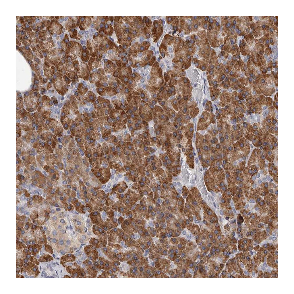 Atlas Antibodies Anti-QRSL1 Antibody