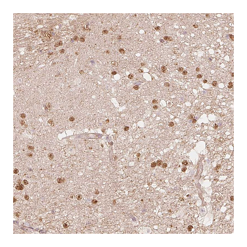 Atlas Antibodies Anti-QDPR Antibody