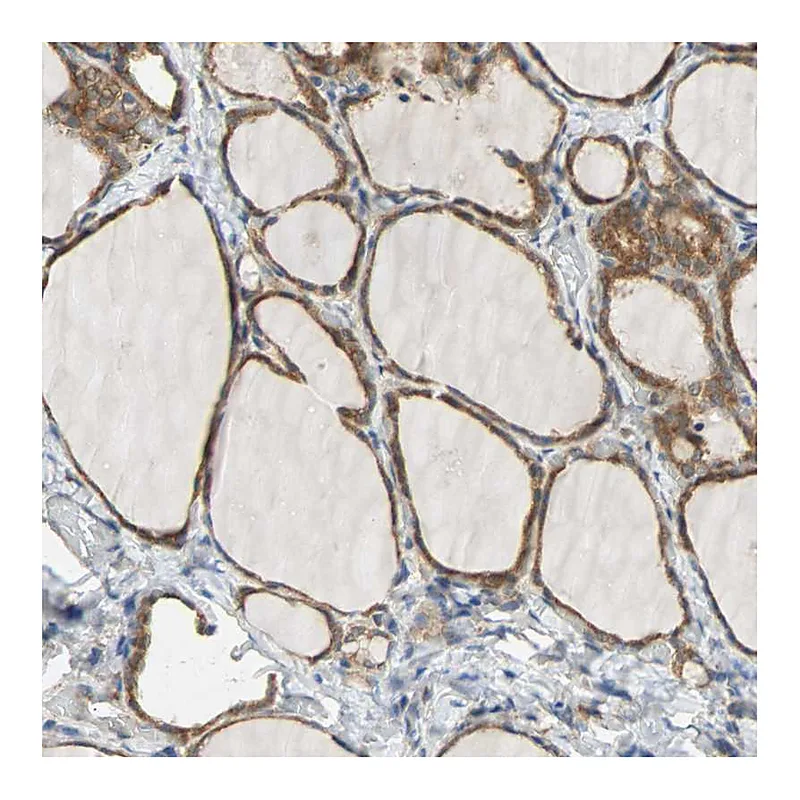 Atlas Antibodies Anti-QSER1 Antibody