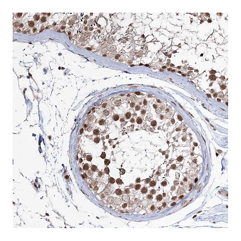 Atlas Antibodies Anti-QRICH1 Antibody