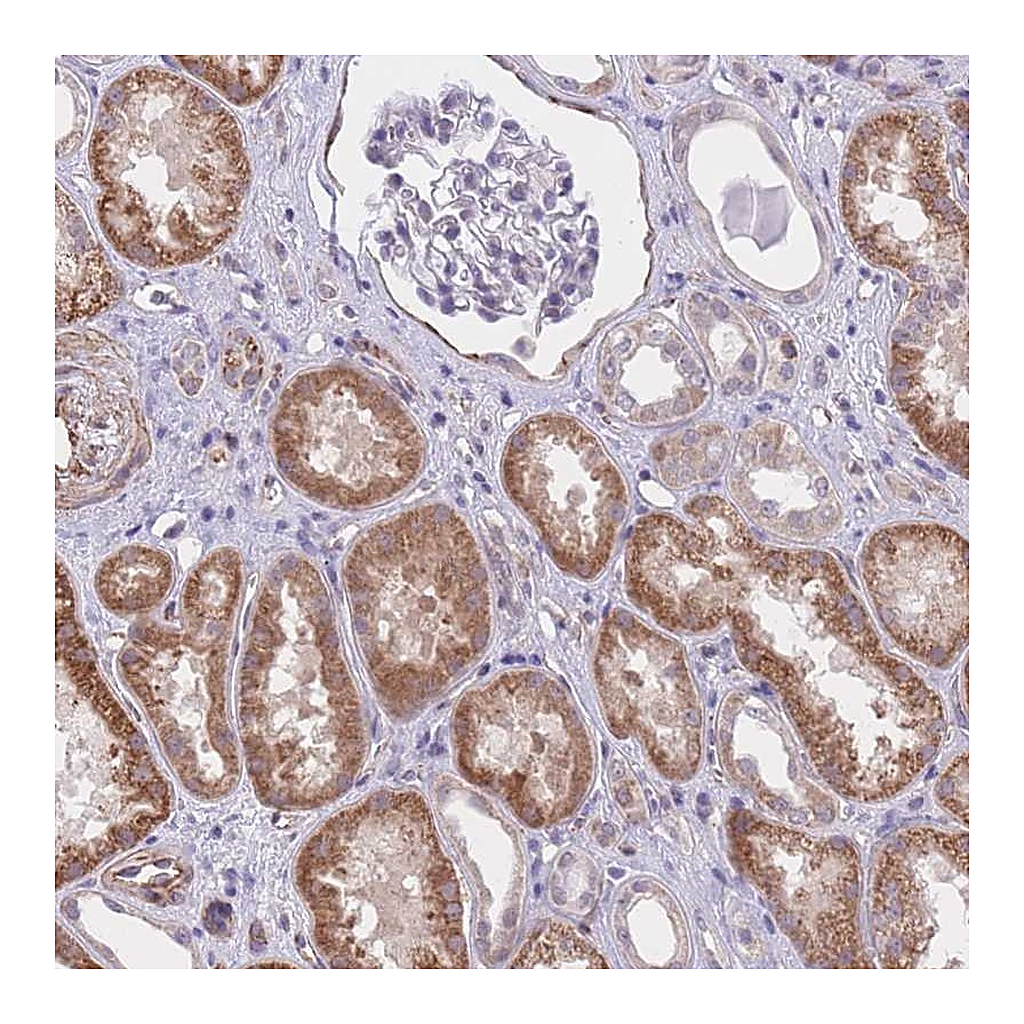 Atlas Antibodies Anti-QTRT1 Antibody