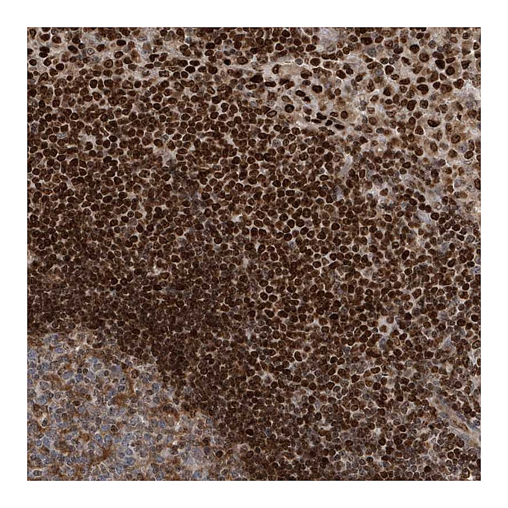 Atlas Antibodies Anti-QTRT2 Antibody