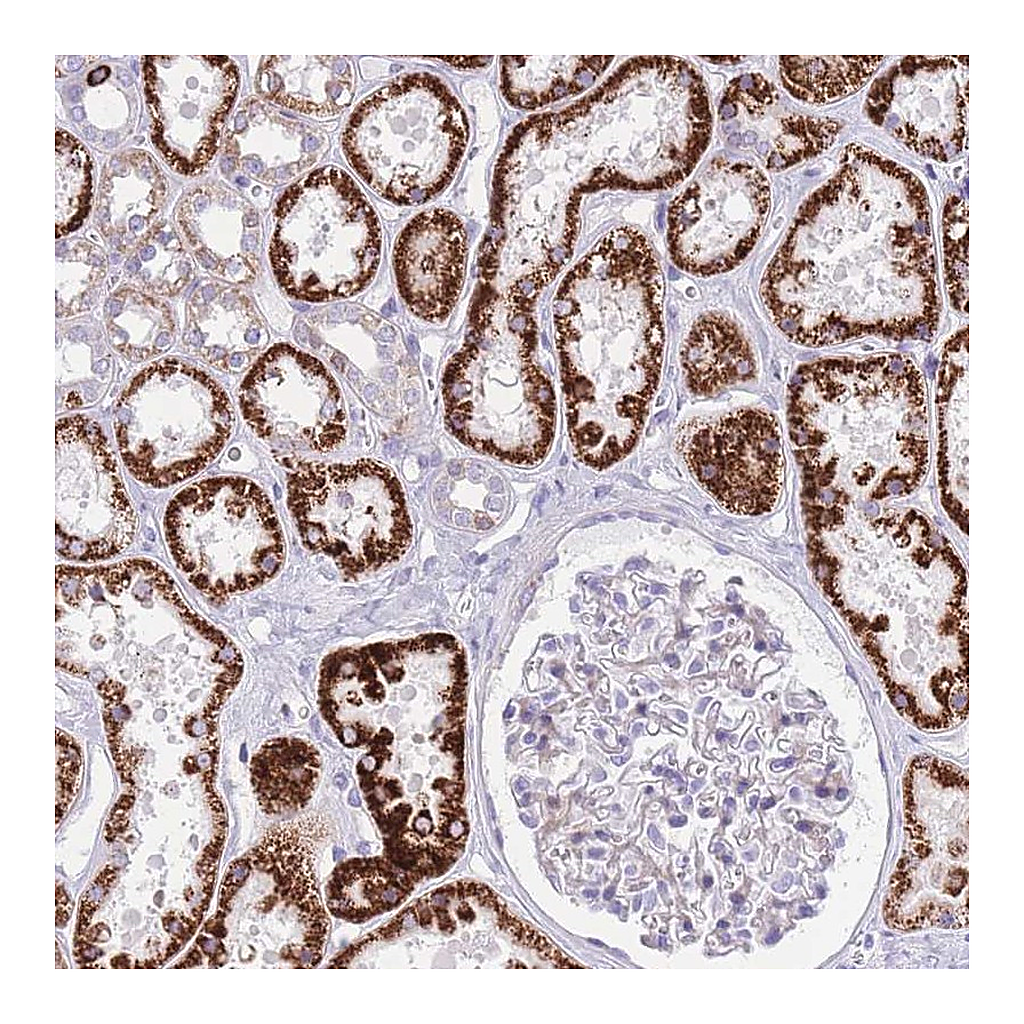 Atlas Antibodies Anti-QTRT1 Antibody