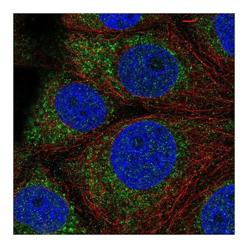 Atlas Antibodies Anti-QTRT1 Antibody