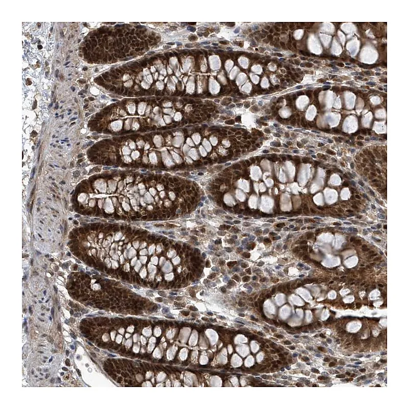Atlas Antibodies Anti-QTRT2 Antibody