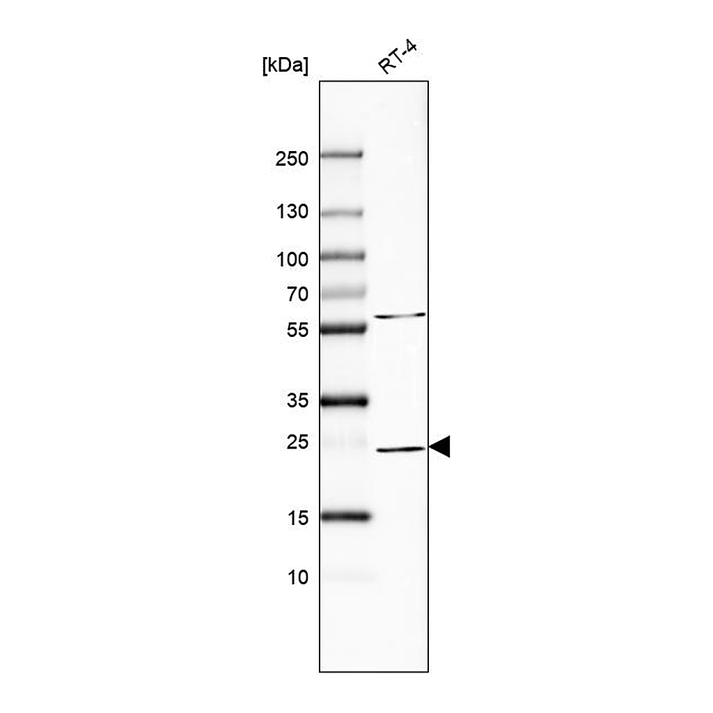 Atlas Antibodies Anti-RAB11A Antibody