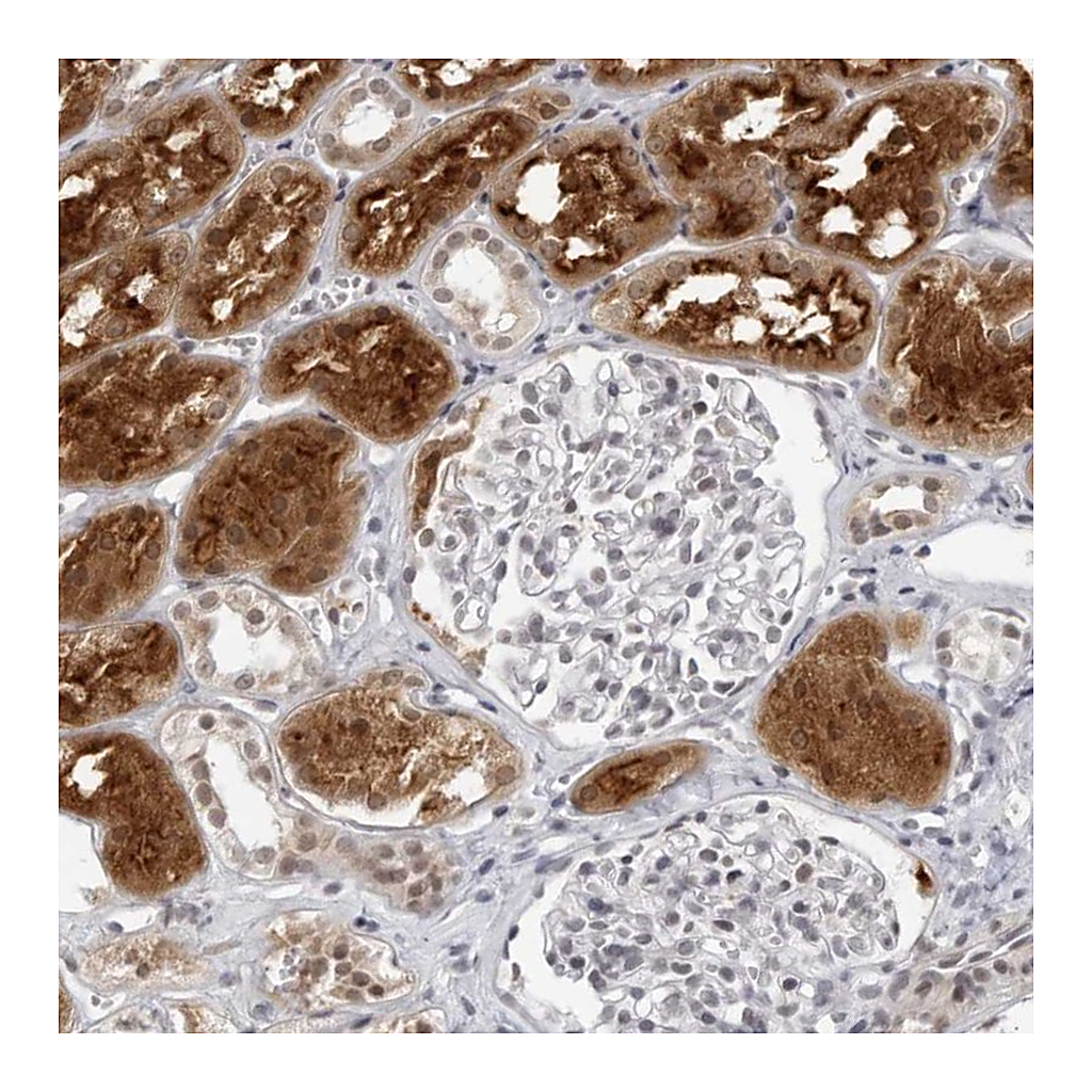 Atlas Antibodies Anti-RAB11FIP3 Antibody