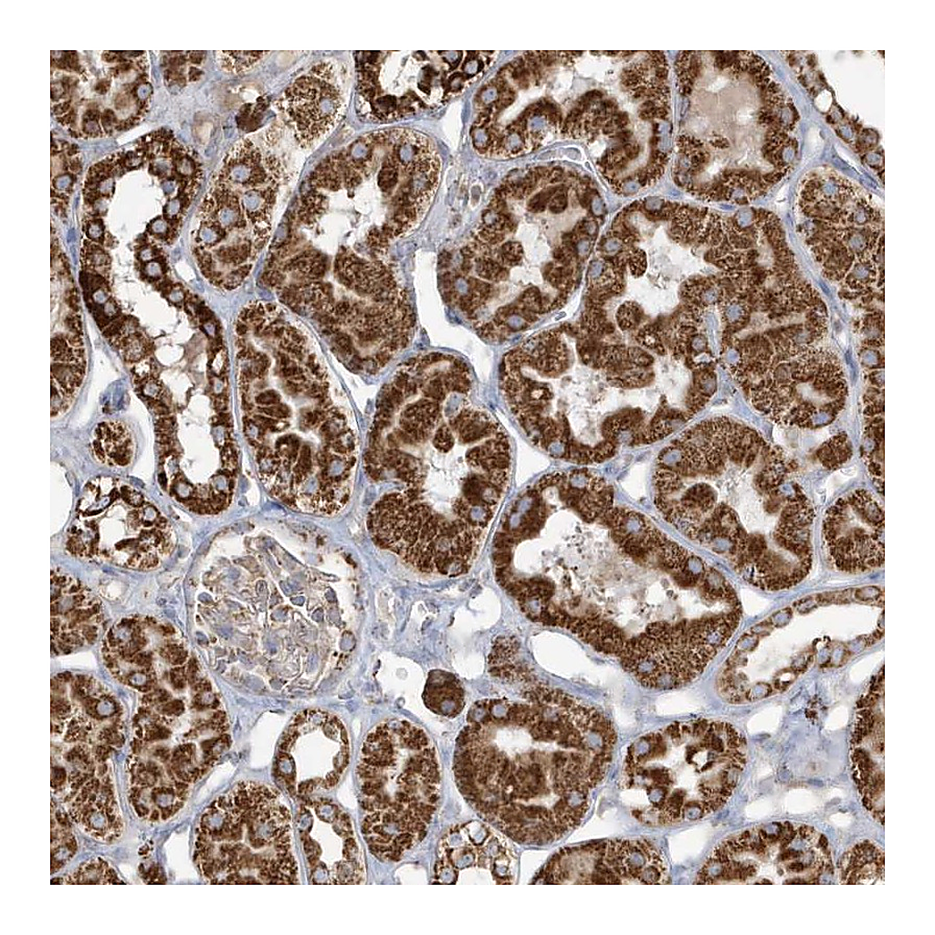 Atlas Antibodies Anti-RAB11FIP3 Antibody