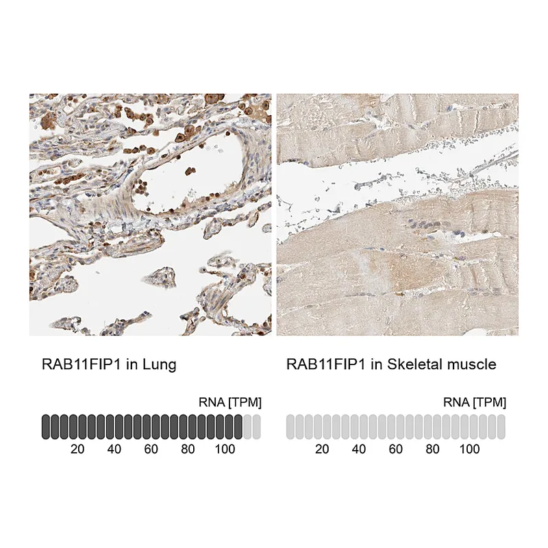 Atlas Antibodies Anti-RAB11FIP1 Antibody