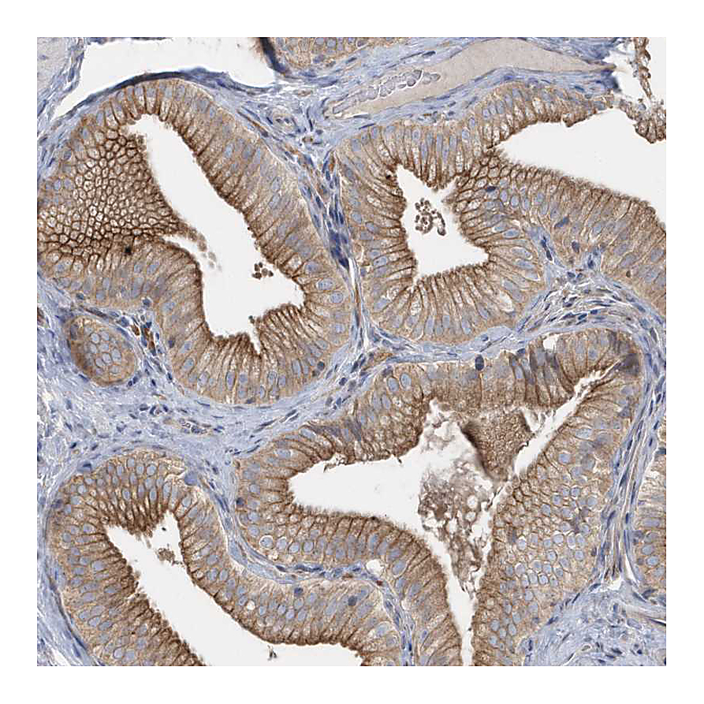 Atlas Antibodies Anti-RAB17 Antibody