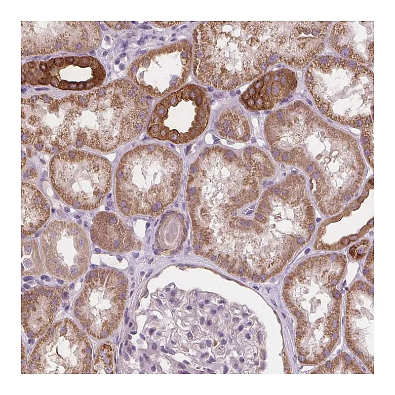 Atlas Antibodies Anti-RAB20 Antibody