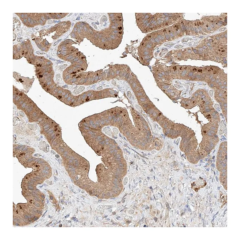 Atlas Antibodies Anti-RAB23 Antibody