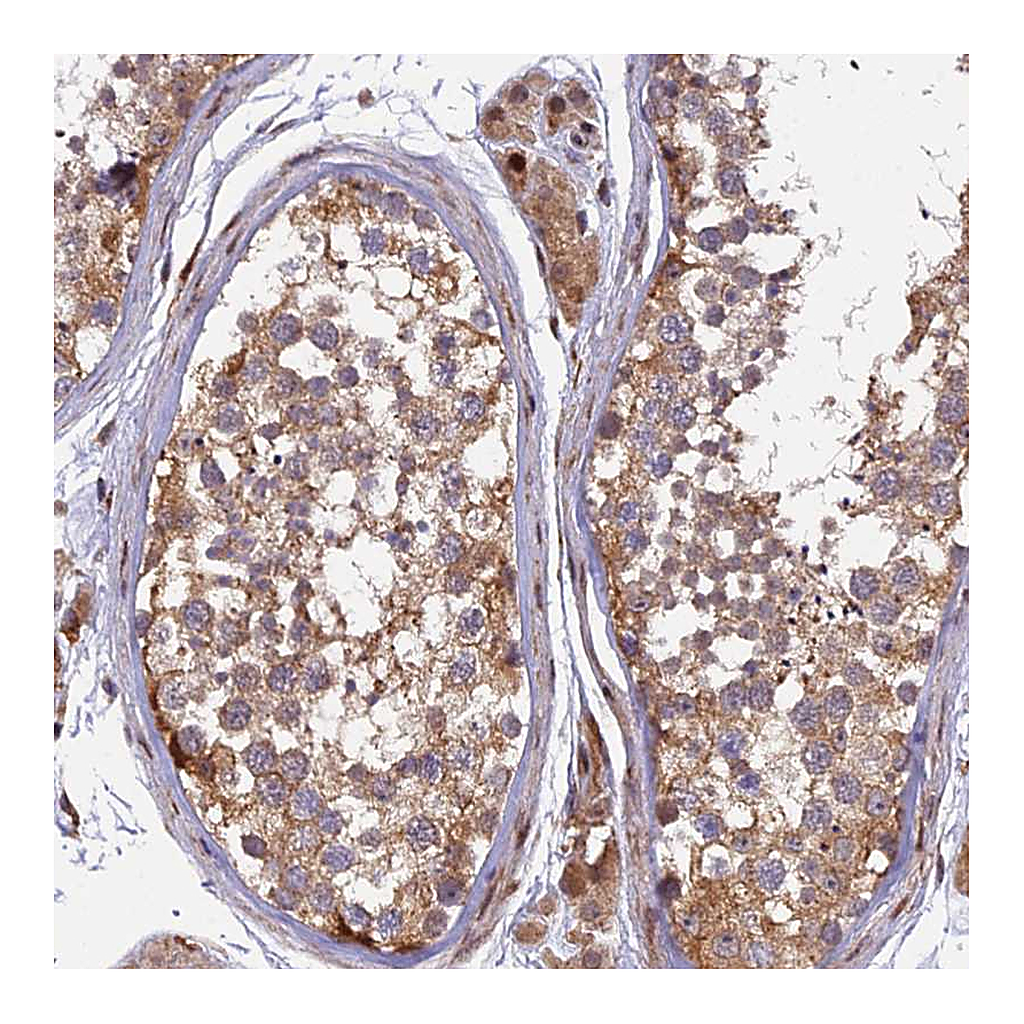 Atlas Antibodies Anti-RAB28 Antibody