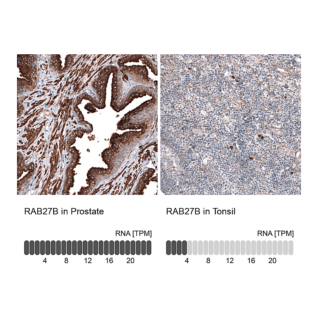 Atlas Antibodies Anti-RAB27B Antibody