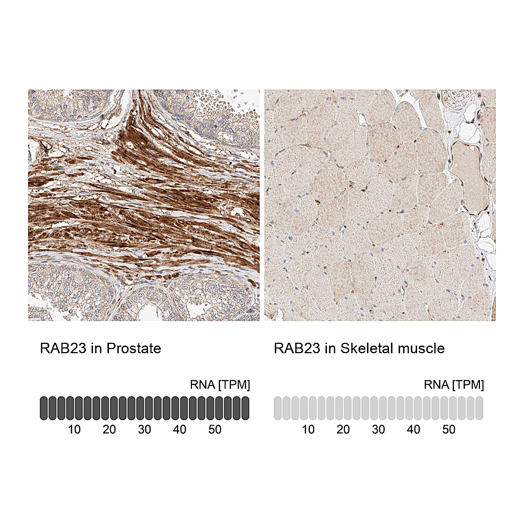 Atlas Antibodies Anti-RAB23 Antibody