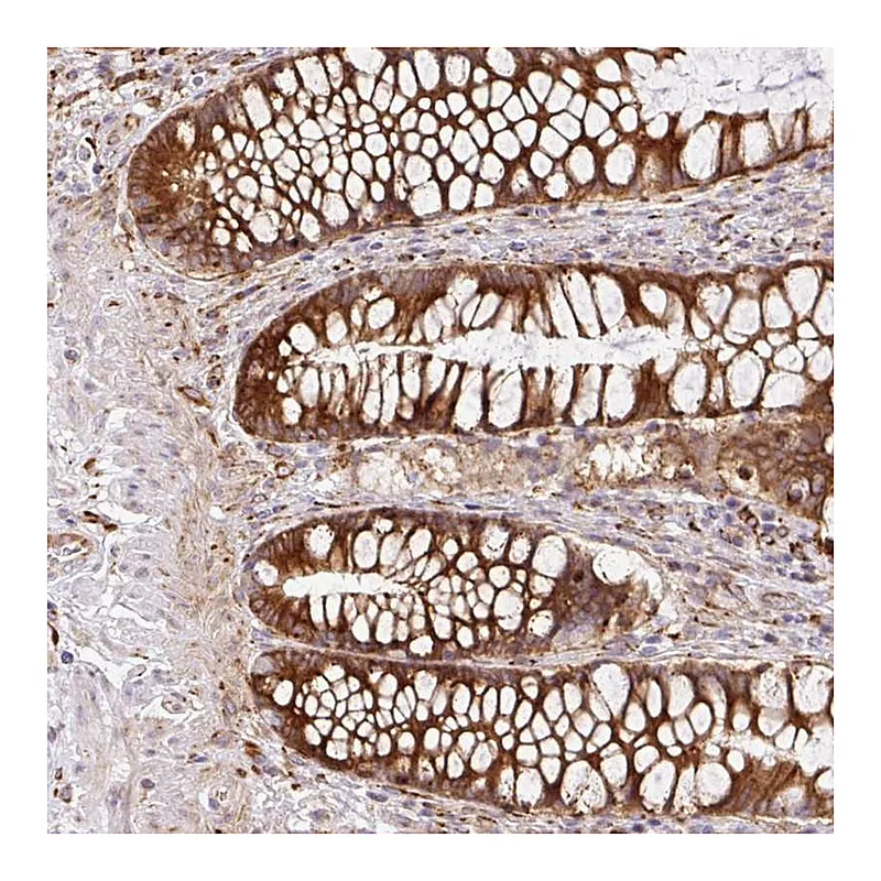 Atlas Antibodies Anti-RAB30 Antibody