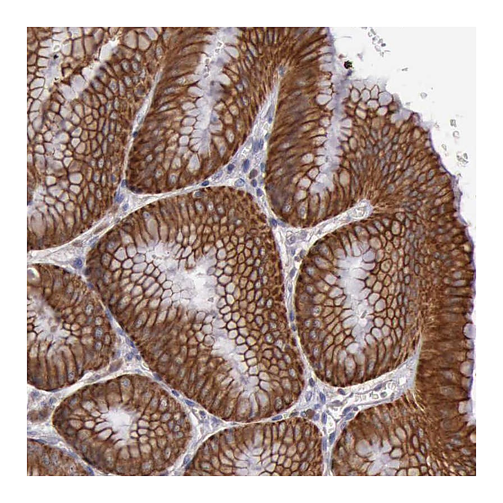 Atlas Antibodies Anti-RAB39B Antibody