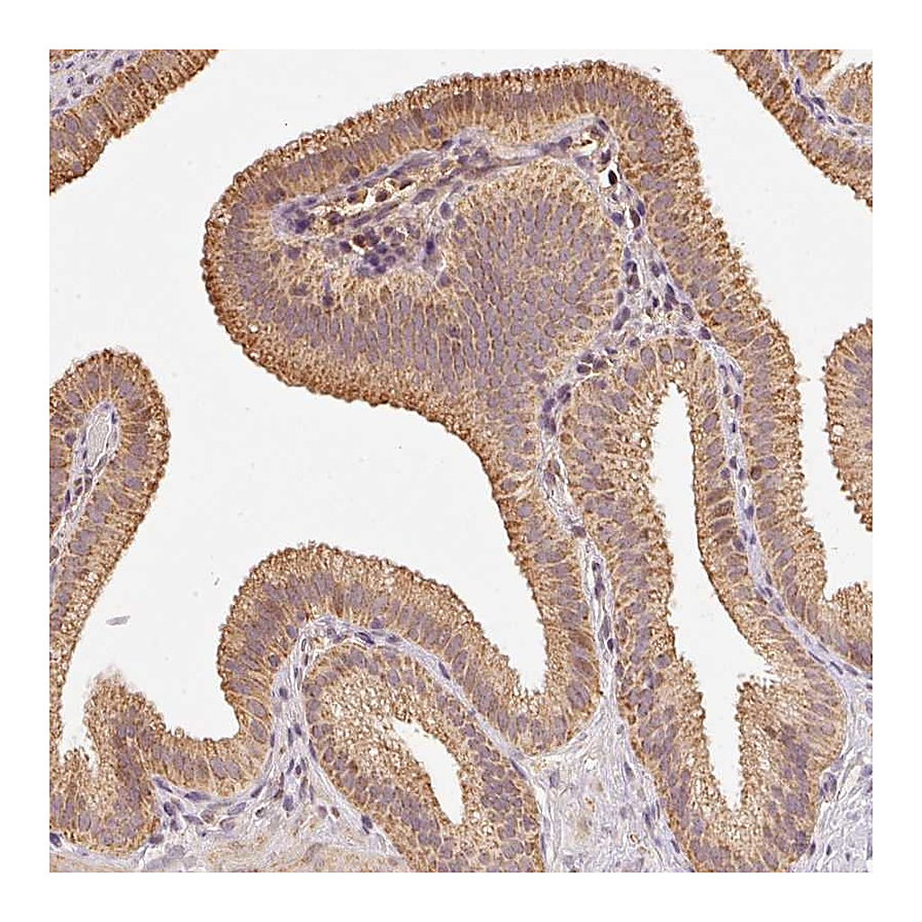 Atlas Antibodies Anti-RAB35 Antibody