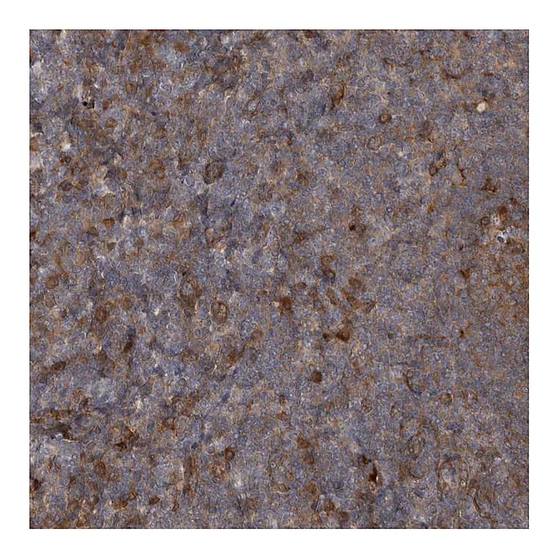Atlas Antibodies Anti-RAB3GAP2 Antibody
