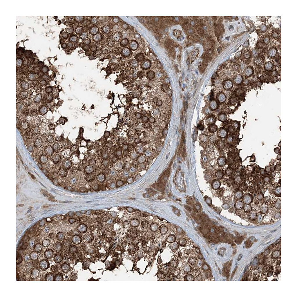 Atlas Antibodies Anti-RAB3GAP1 Antibody