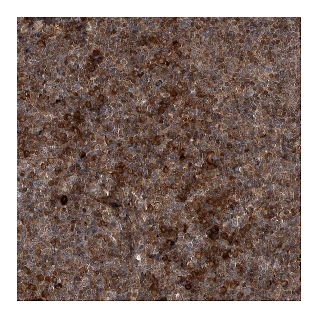 Atlas Antibodies Anti-RAB3GAP2 Antibody