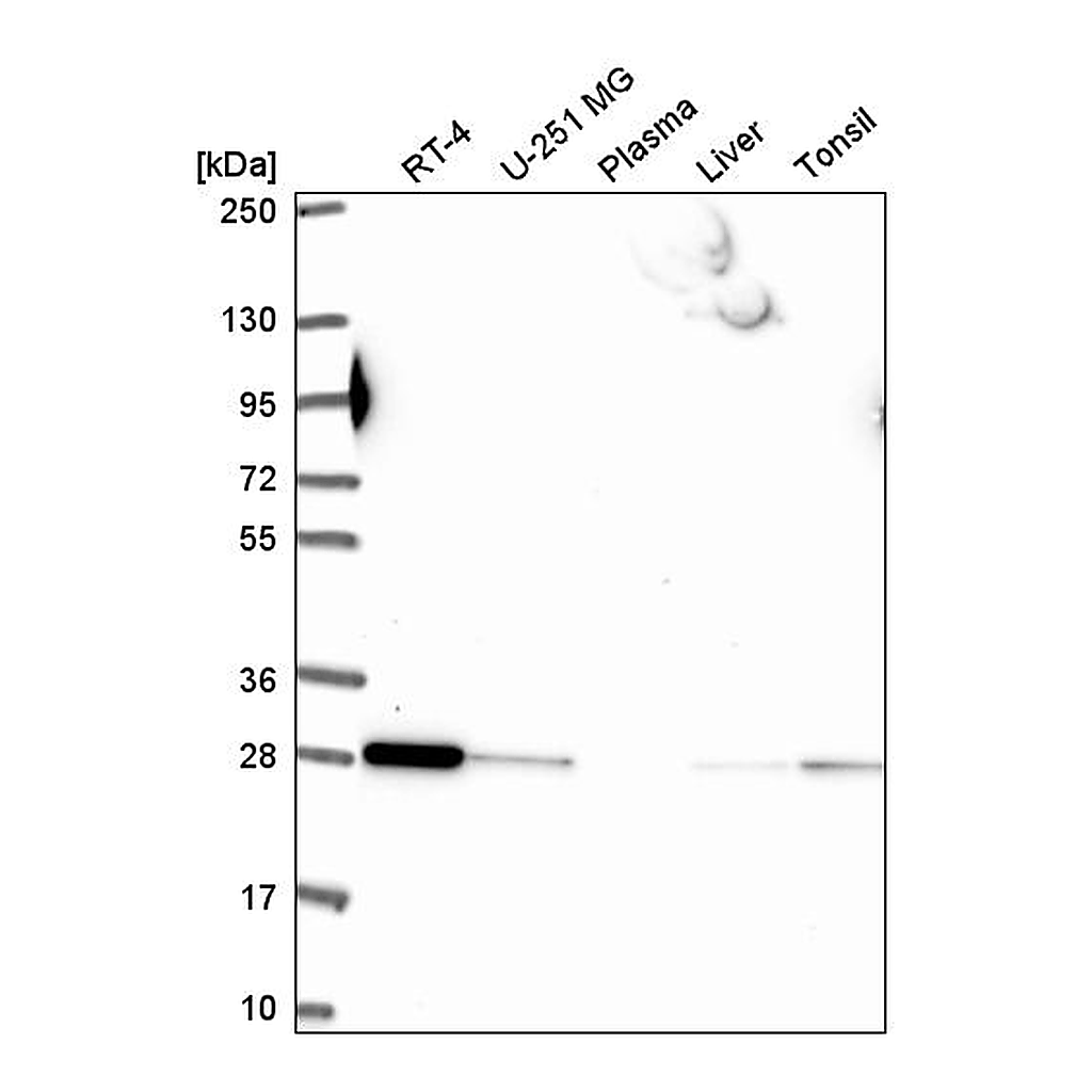 Atlas Antibodies Anti-RAB5B Antibody