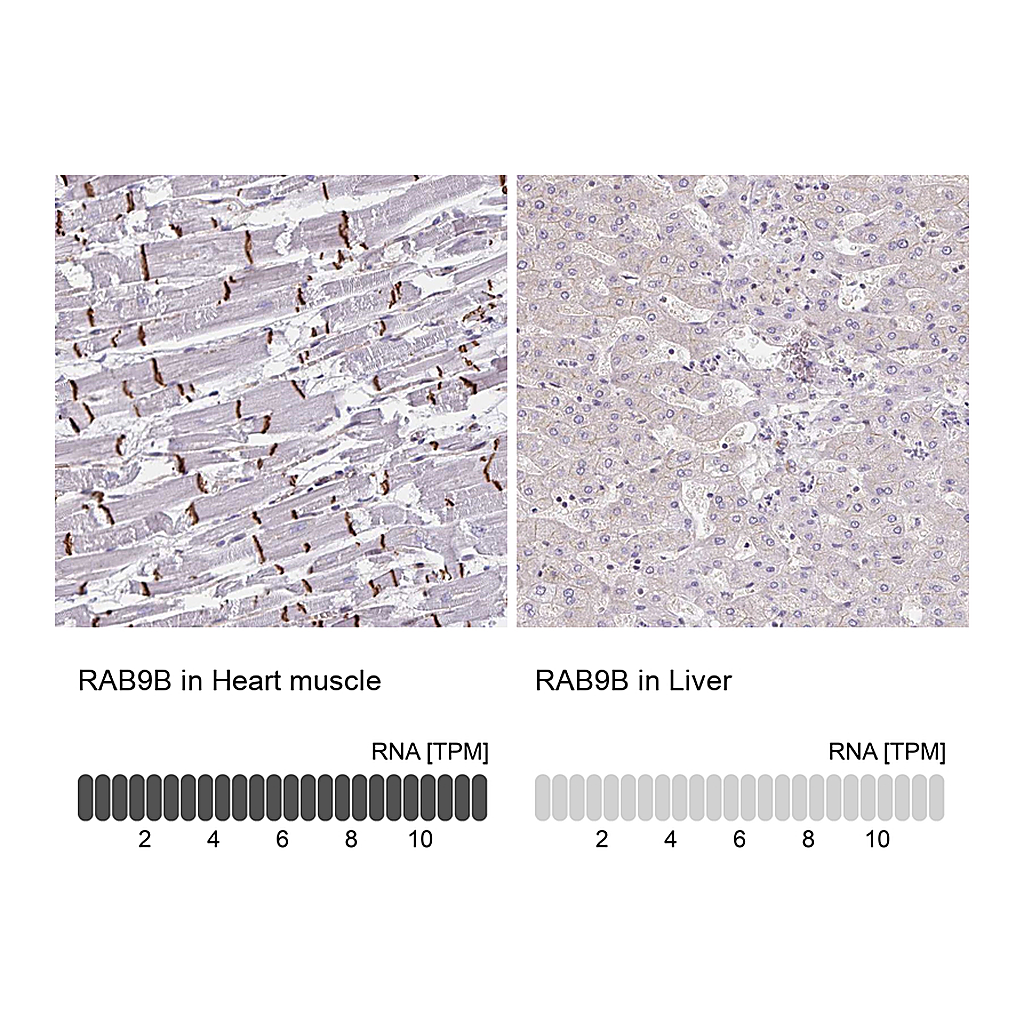 Atlas Antibodies Anti-RAB9B Antibody