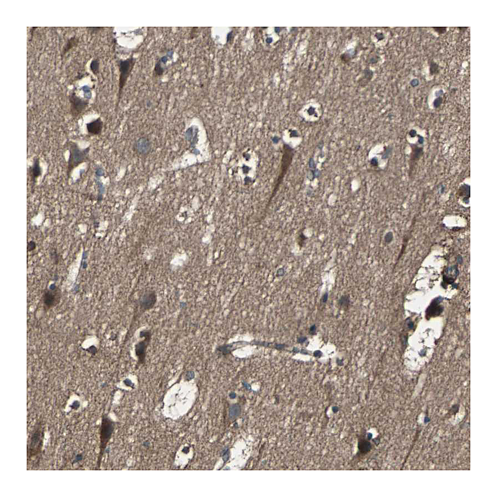 Atlas Antibodies Anti-RAB7A Antibody