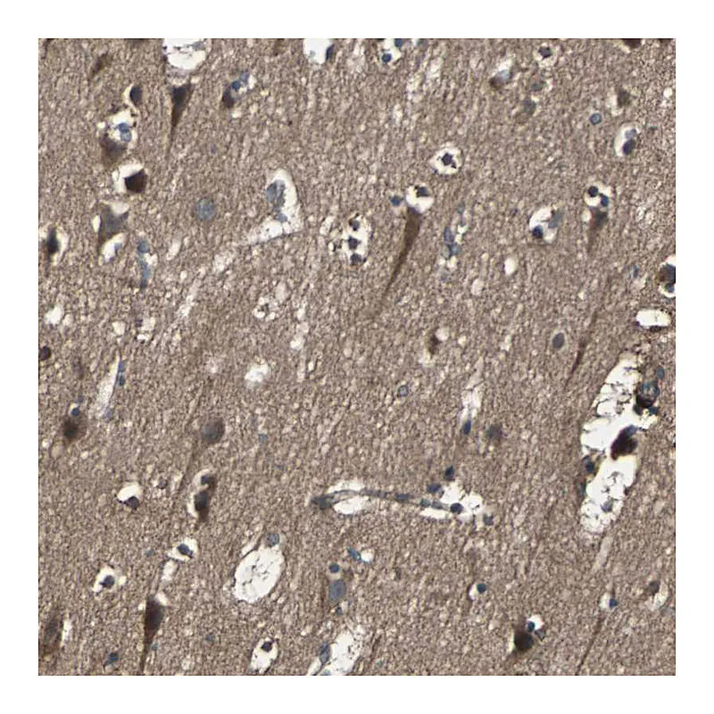 Atlas Antibodies Anti-RAB7A Antibody