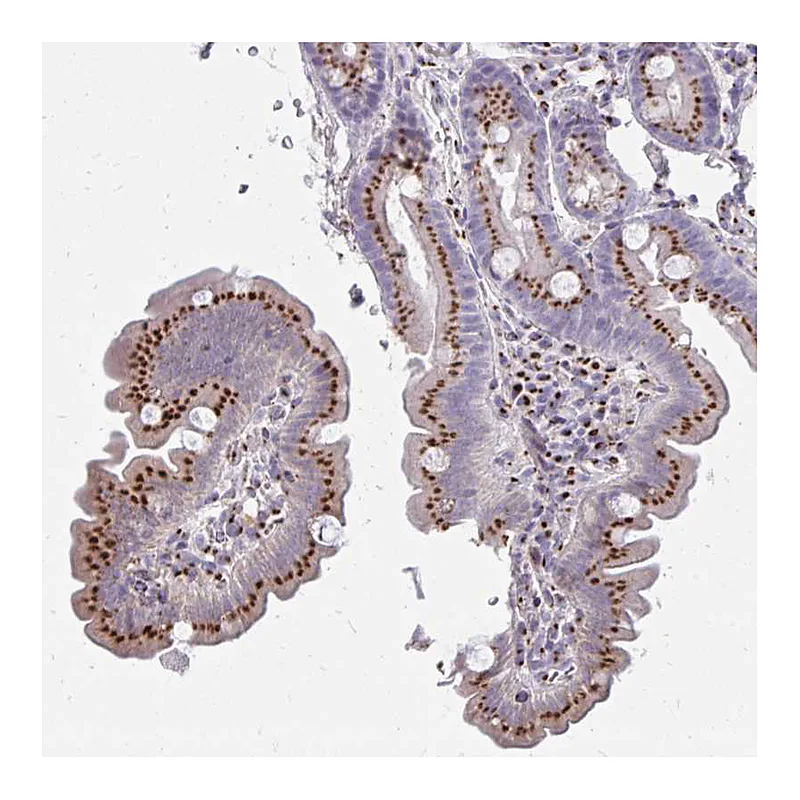 Atlas Antibodies Anti-RAB6A Antibody