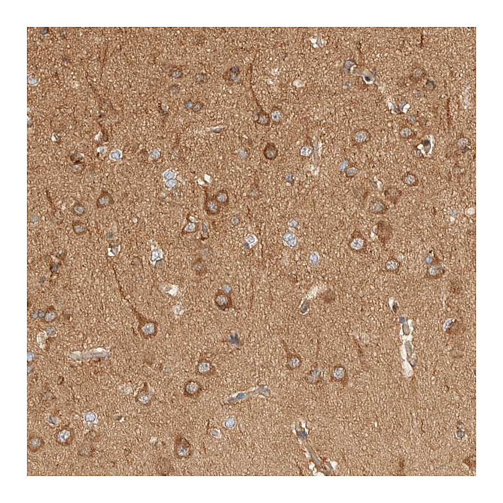Atlas Antibodies Anti-RABEP1 Antibody