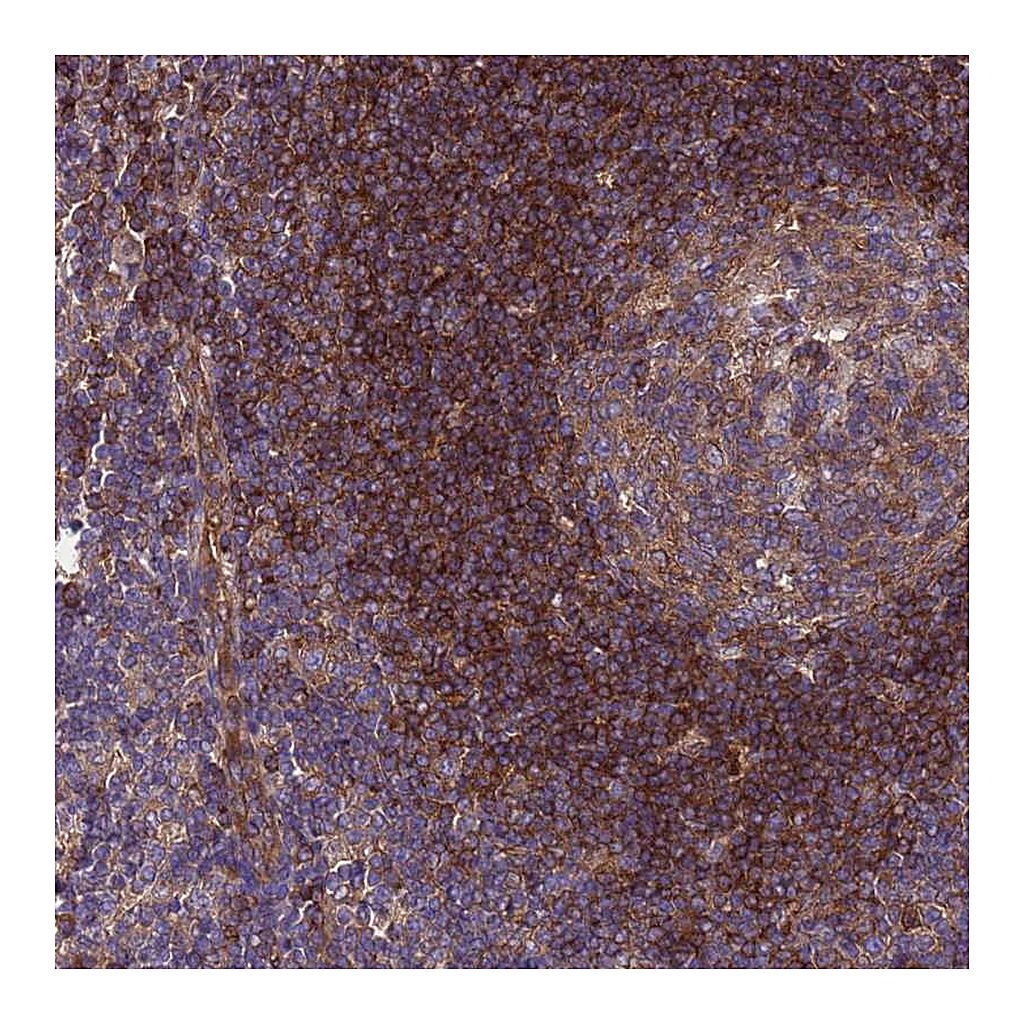 Atlas Antibodies Anti-RABEP2 Antibody