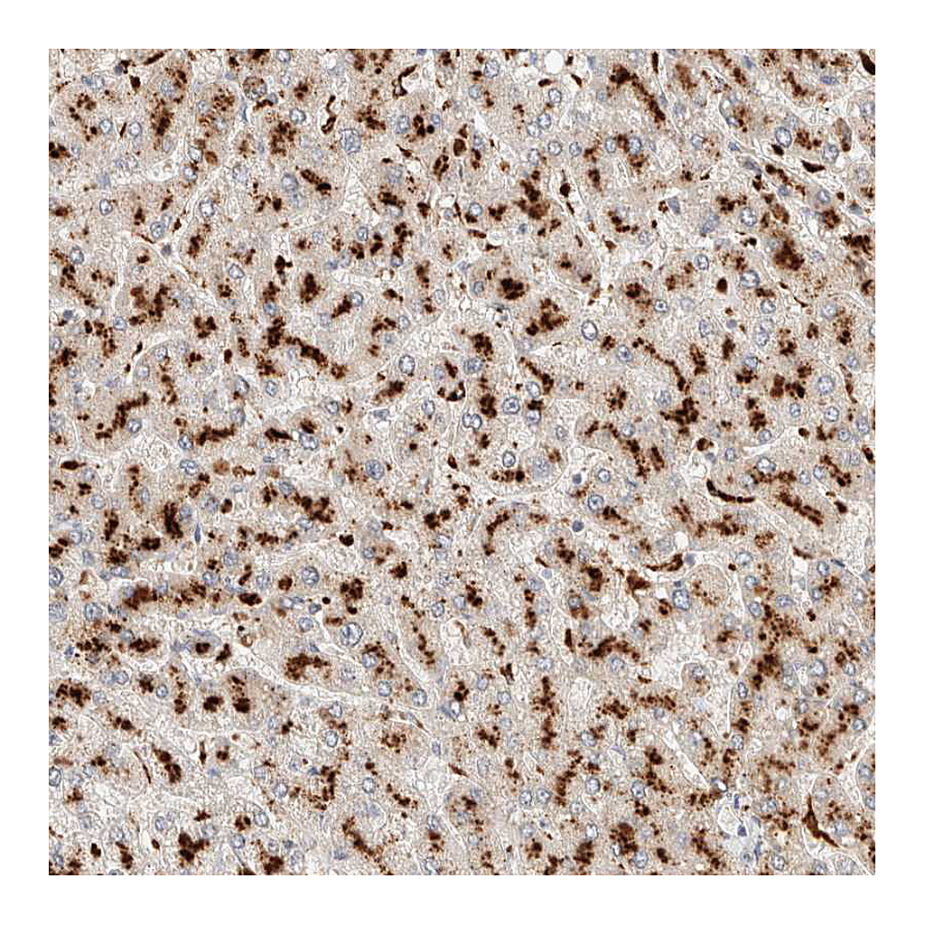Atlas Antibodies Anti-RABEPK Antibody