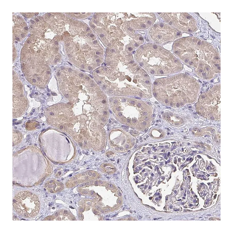 Atlas Antibodies Anti-RABGAP1L Antibody