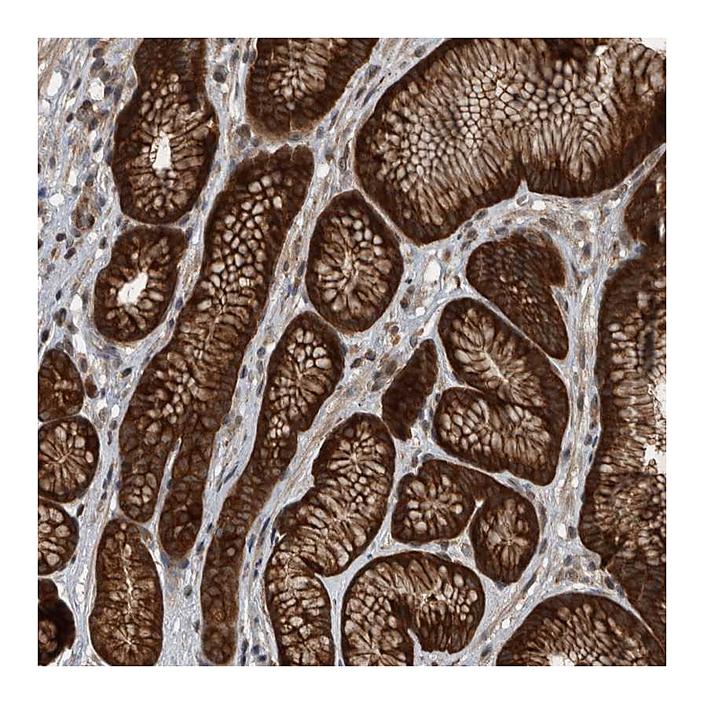 Atlas Antibodies Anti-RABGGTB Antibody