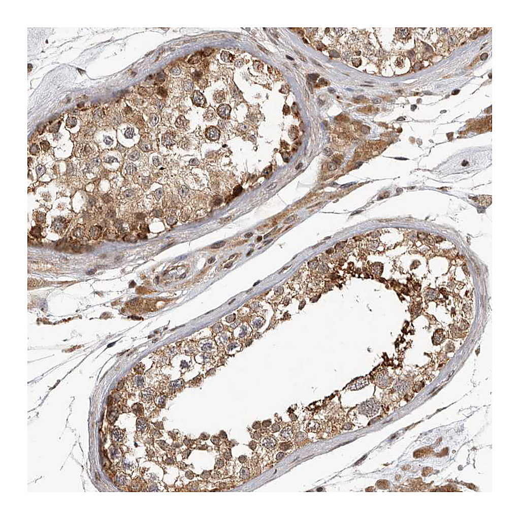 Atlas Antibodies Anti-RABIF Antibody