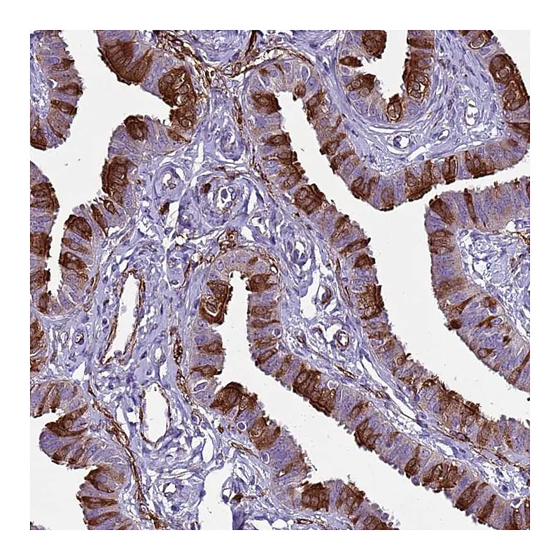 Atlas Antibodies Anti-RABL2A Antibody