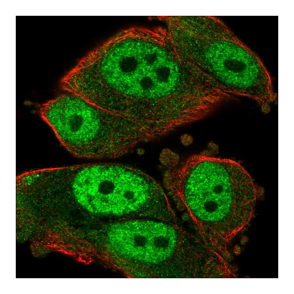Atlas Antibodies Anti-RAD23A Antibody